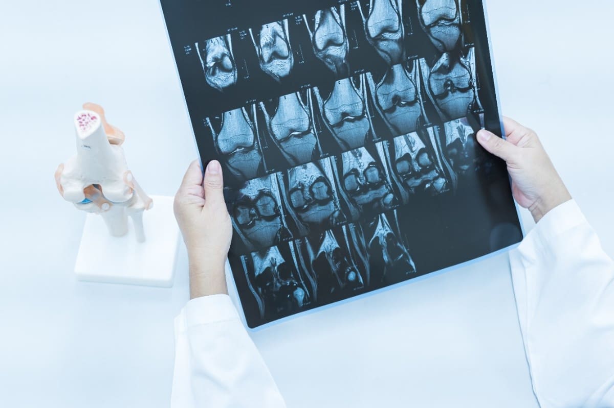 Department Image: Department of Orthopedics